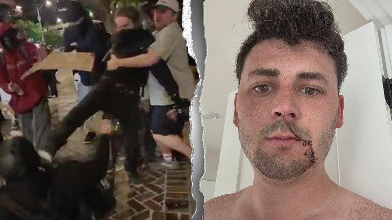 Image for Seattle journalists attacked by agitators call out far-left media for covering up violence at protests